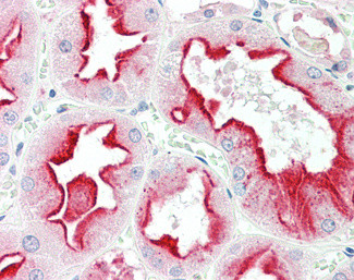 Apolipoprotein D Antibody in Immunohistochemistry (Paraffin) (IHC (P))