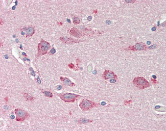 BMP1 Antibody in Immunohistochemistry (Paraffin) (IHC (P))