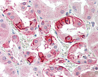 Carbonic Anhydrase XII Antibody in Immunohistochemistry (Paraffin) (IHC (P))
