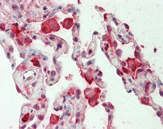 CAPG Antibody in Immunohistochemistry (Paraffin) (IHC (P))