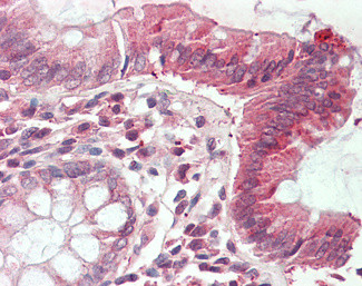 CLIC1 Antibody in Immunohistochemistry (Paraffin) (IHC (P))