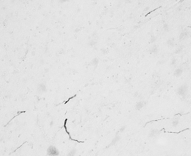 FGF14 Antibody in Immunohistochemistry (PFA fixed) (IHC (PFA))