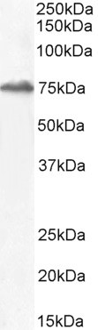 HIC1 Antibody in Western Blot (WB)