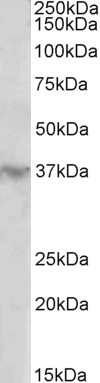 HOXD12 Antibody in Western Blot (WB)