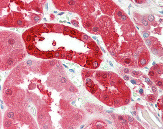 PNP Antibody in Immunohistochemistry (Paraffin) (IHC (P))