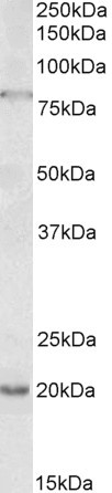 OAS2 Antibody in Western Blot (WB)