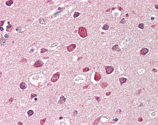 SH3GL2 Antibody in Immunohistochemistry (Paraffin) (IHC (P))