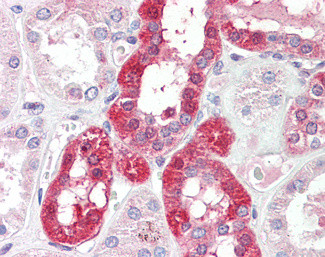 SLC6A8 Antibody in Immunohistochemistry (Paraffin) (IHC (P))