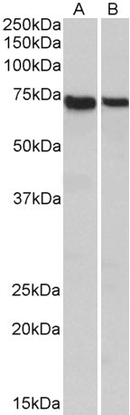 STXBP3 Antibody in Western Blot (WB)