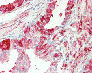 TGM4 Antibody in Immunohistochemistry (Paraffin) (IHC (P))