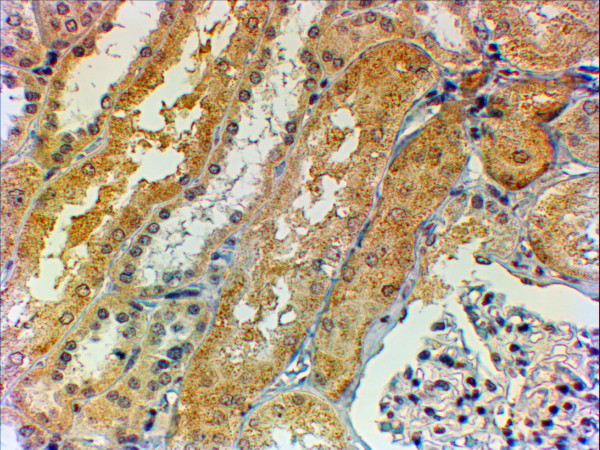 Tensin 1 Antibody in Immunohistochemistry (Paraffin) (IHC (P))