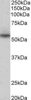 NPRL3 Antibody in Western Blot (WB)