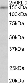 SynGAP Antibody in Western Blot (WB)