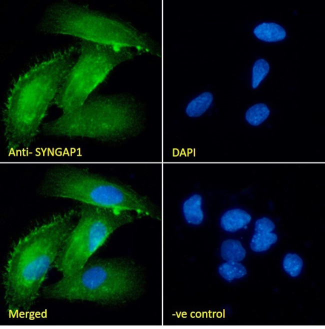 SynGAP Antibody in Immunocytochemistry (ICC/IF)