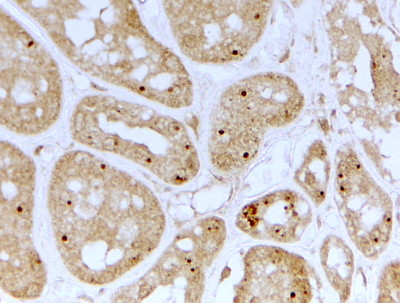 NOLC1 Antibody in Immunohistochemistry (Paraffin) (IHC (P))