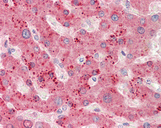 RPL23 Antibody in Immunohistochemistry (Paraffin) (IHC (P))