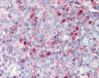 SPON2 Antibody in Immunohistochemistry (Paraffin) (IHC (P))
