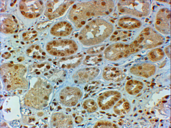 DMRT2 Antibody in Immunohistochemistry (Paraffin) (IHC (P))