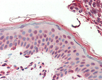 SRCAP Antibody in Immunohistochemistry (Paraffin) (IHC (P))