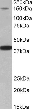 IRS4 Antibody in Western Blot (WB)