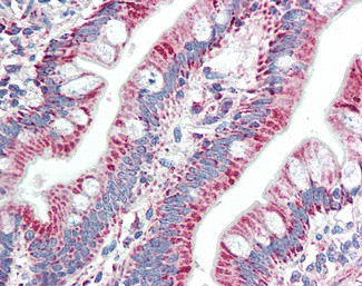ZNF652 Antibody in Immunohistochemistry (Paraffin) (IHC (P))