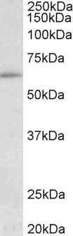 HIC2 Antibody in Western Blot (WB)
