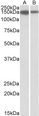 MCF2L Antibody in Western Blot (WB)