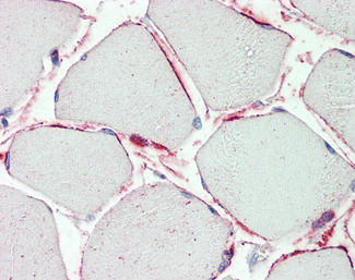 PI15 Antibody in Immunohistochemistry (Paraffin) (IHC (P))