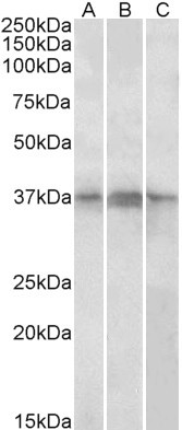 PHF11 Antibody in Western Blot (WB)