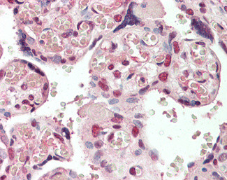 CREB3L2 Antibody in Immunohistochemistry (Paraffin) (IHC (P))
