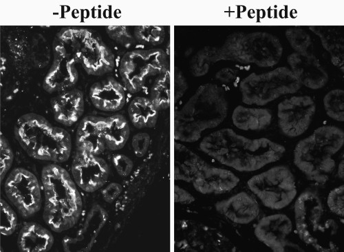 SLC26A6 Antibody in Immunohistochemistry (Paraffin) (IHC (P))