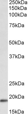 WFDC1 Antibody in Western Blot (WB)
