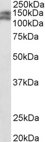 PARD3B Antibody in Western Blot (WB)