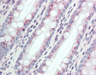 CCDC3 Antibody in Immunohistochemistry (Paraffin) (IHC (P))