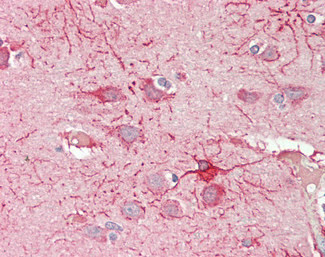 CROT Antibody in Immunohistochemistry (Paraffin) (IHC (P))