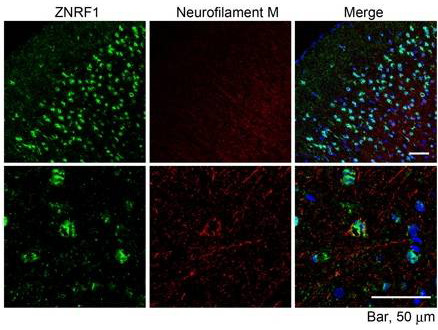 ZNRF1 Antibody in Immunohistochemistry (Paraffin) (IHC (P))