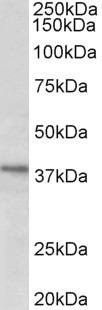 C12orf29 Antibody in Western Blot (WB)