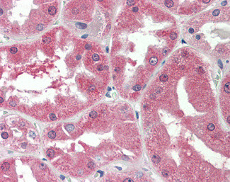SLC47A2 Antibody in Immunohistochemistry (Paraffin) (IHC (P))