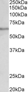 SLC47A2 Antibody in Western Blot (WB)
