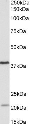 KLHDC8B Antibody in Western Blot (WB)