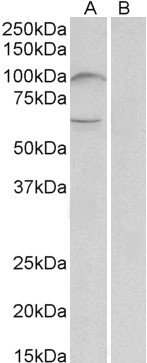 UNC5B Antibody in Western Blot (WB)