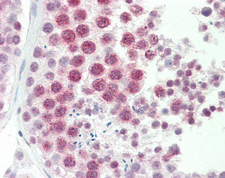 DNAJC5G Antibody in Immunohistochemistry (Paraffin) (IHC (P))