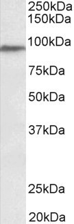 PTCHD3 Antibody in Western Blot (WB)