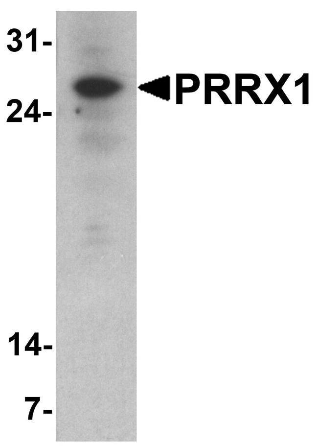 PRRX1 Antibody in Western Blot (WB)