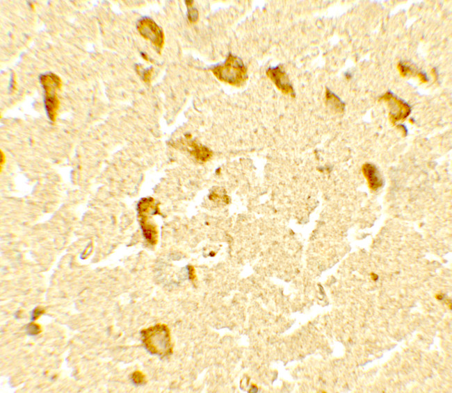 DPF3 Antibody in Immunohistochemistry (Paraffin) (IHC (P))
