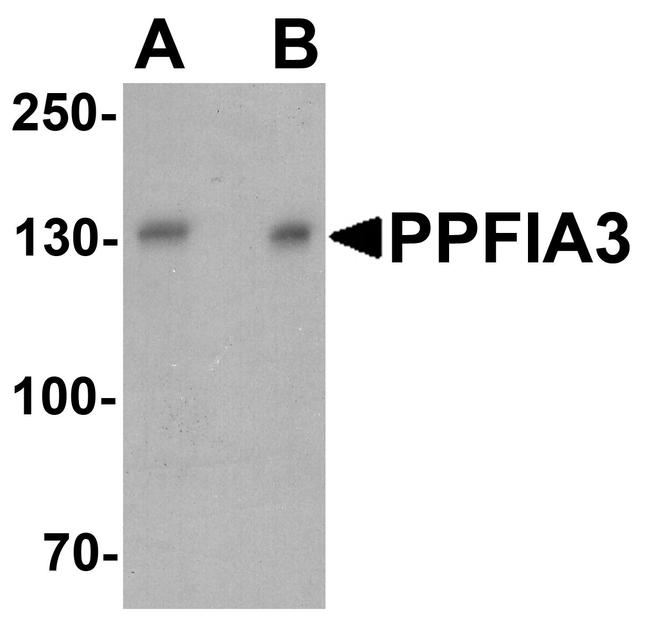 PPFIA3 Antibody in Western Blot (WB)