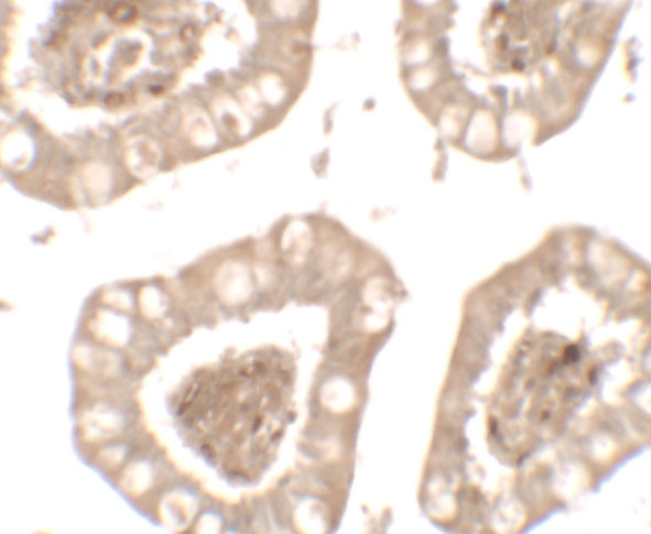 IL1RL2 Antibody in Immunohistochemistry (Paraffin) (IHC (P))