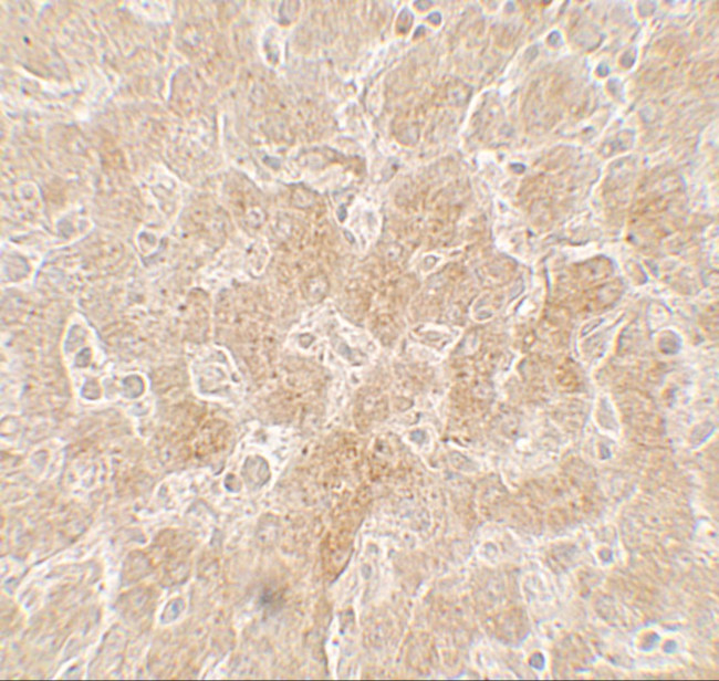 PPARGC1A Antibody in Immunohistochemistry (IHC)