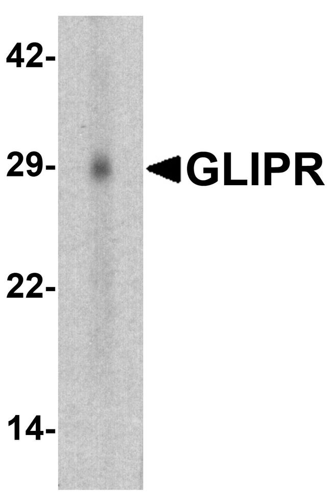 GLIPR1 Antibody in Western Blot (WB)
