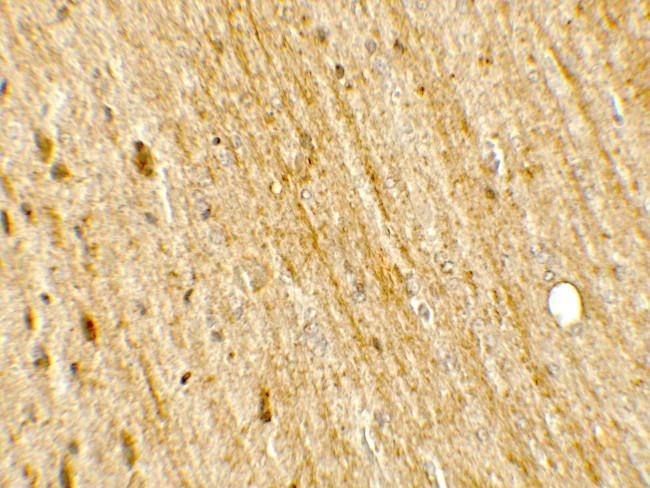 PLA1 Antibody in Immunohistochemistry (Paraffin) (IHC (P))